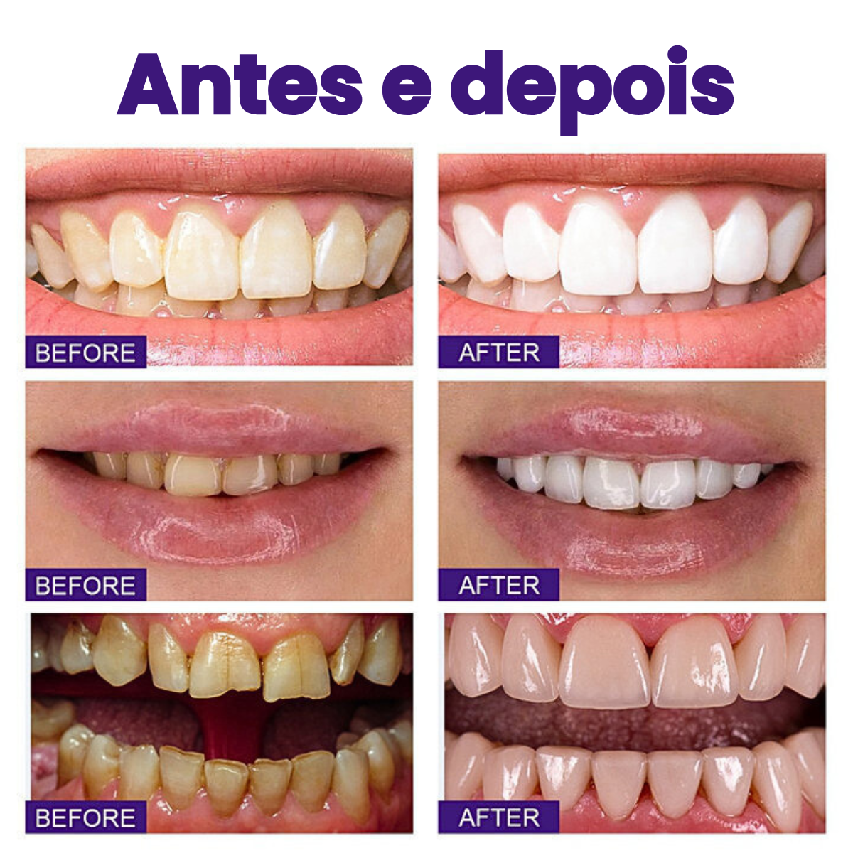 Crema Dental Blanqueadora Hismile V34